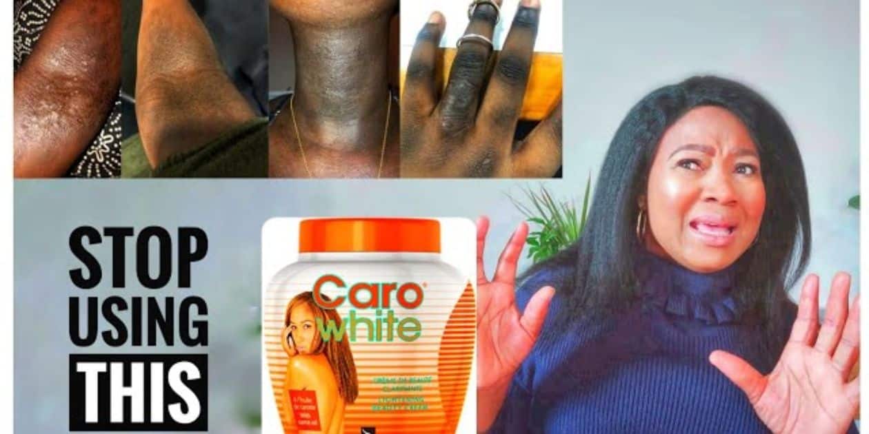 What Are The Side Effects Of Caro White Cream?