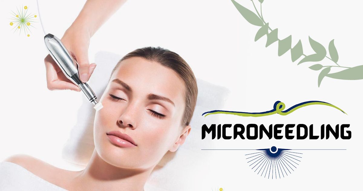Can I Wear Makeup After Microneedling?