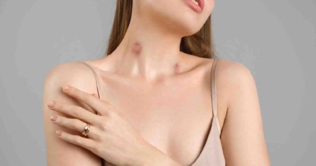 Expert Advice on Concealing Neck Bruises