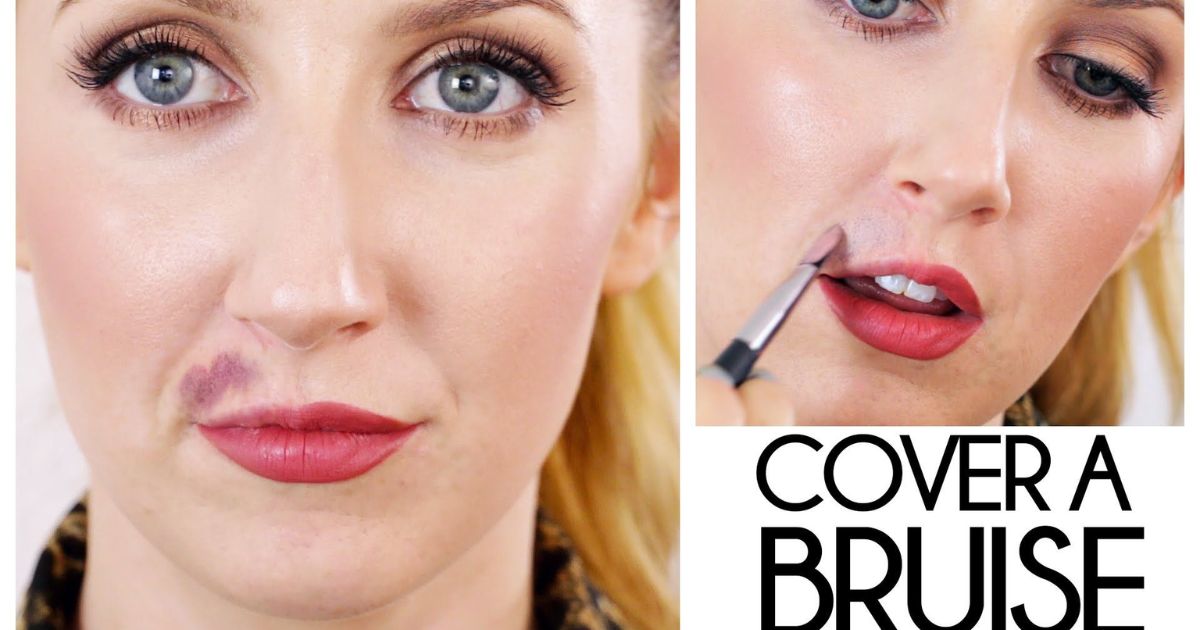 How to Cover a Green Bruise With Makeup?