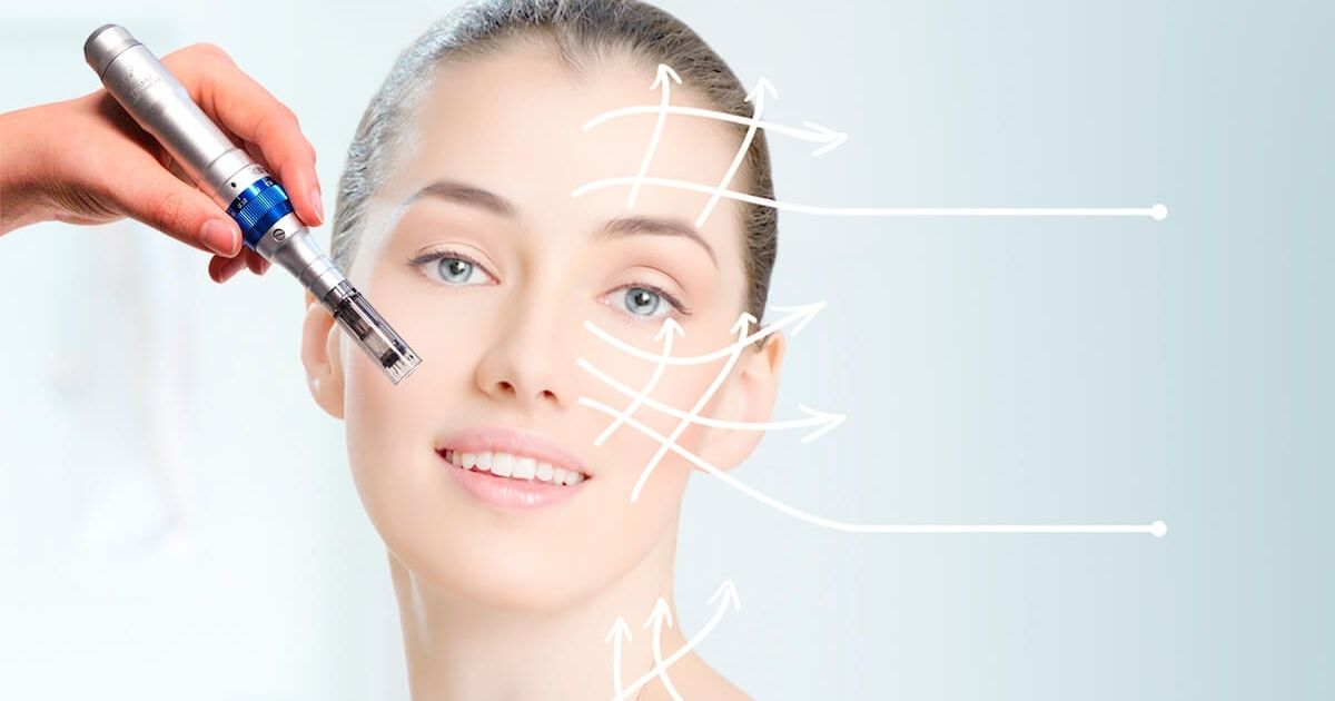 When Can You Wear Makeup After Microneedling?