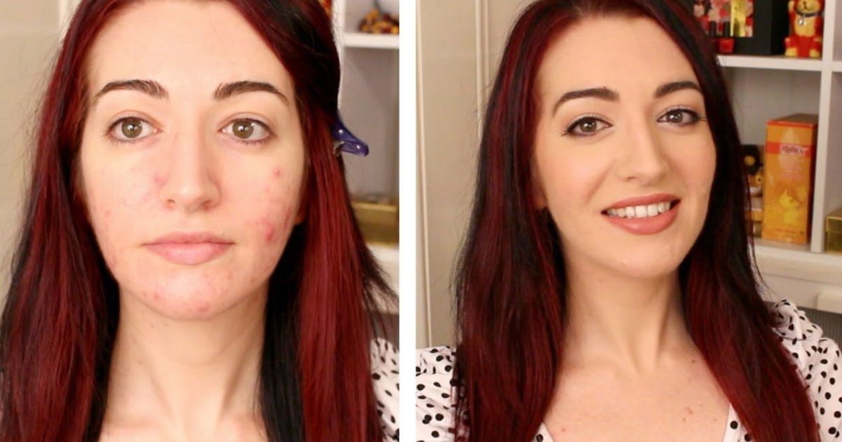 Is Seint Makeup Good for Acne-Prone Skin?