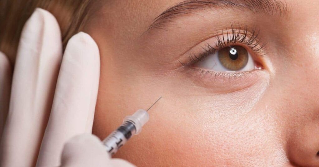 The Cost of Under Eye Filler: What to Expect